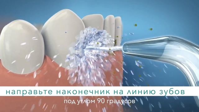 Как пользоваться ирригатором смотреть онлайн