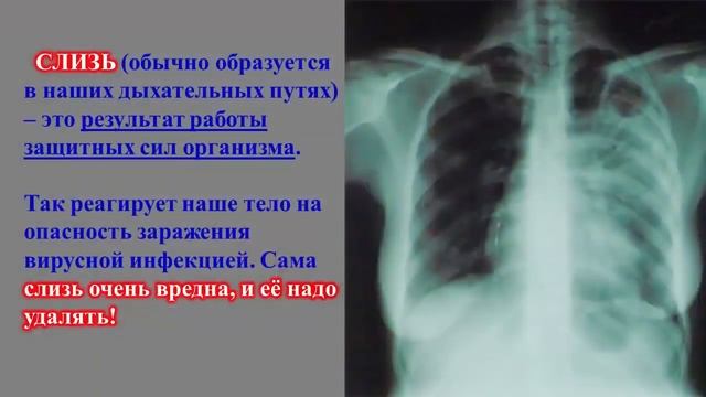 О ЧЕМ НЕ ГОВОРЯТ – Слизь в Горле - КАК избавиться Как понизить Холестерин! смотреть онлайн