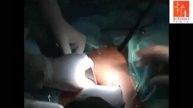 x cone insertion Ramesh смотреть онлайн