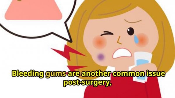 invideo-ai-720 Master Gum Protection Post-Surgery! 2024-06-23