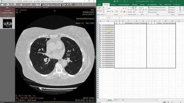 Установка Radiant и разметка очагов