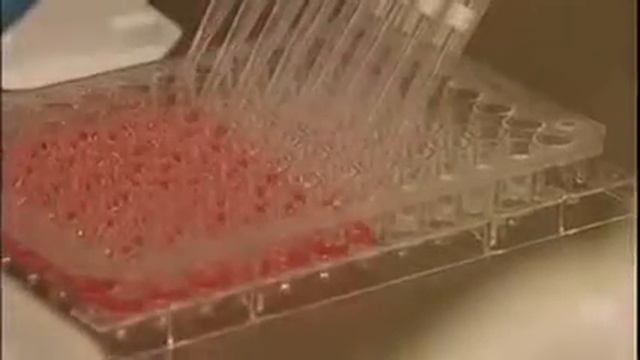 150301 ABC TV 1900 Niemann Picks Disease RMH Mark Walterfang смотреть онлайн