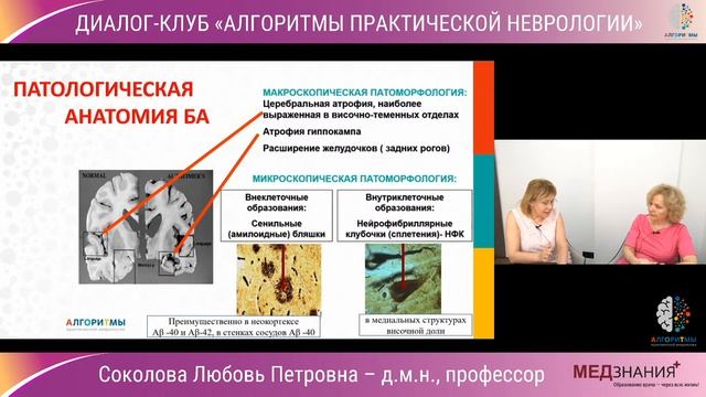 ДИАЛОГ-КЛУБ "АЛГОРИТМЫ ПРАКТИЧЕСКОЙ НЕВРОЛОГИИ" смотреть онлайн
