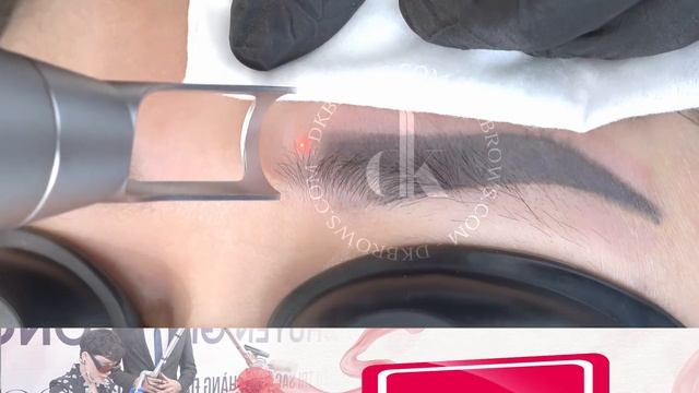 GIẢM NGAY 40% XOÁ XĂM LASER PICOMAX - CHỈ 200 SUẤT ĐĂNG KÝ ĐẦU TIÊN смотреть онлайн