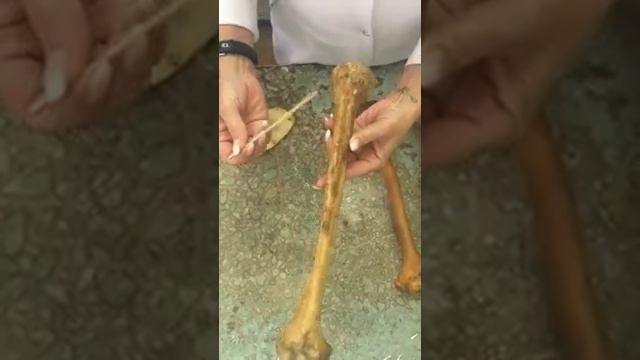 Плечевая кость.