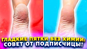 Пяточки как у «Принцессы» без ванночек, нашатыря! Два ингредиента и стопы без натоптышей и трещин!