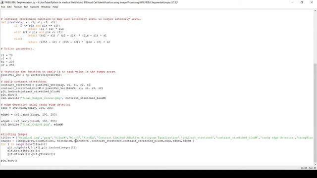 Blood Cell Identification using Image Processing | find and count WBC, RBC using python. Karan Pate смотреть онлайн
