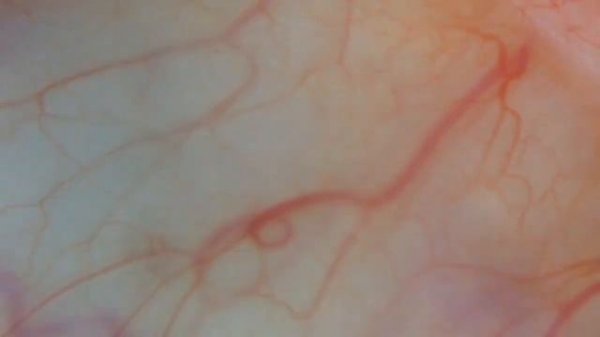 ГЛАЗ ПОД МИКРОСКОПОМ - EYE UNDER MICROSCOPE