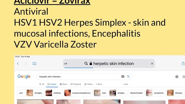 Aciclovir Part 1 смотреть онлайн