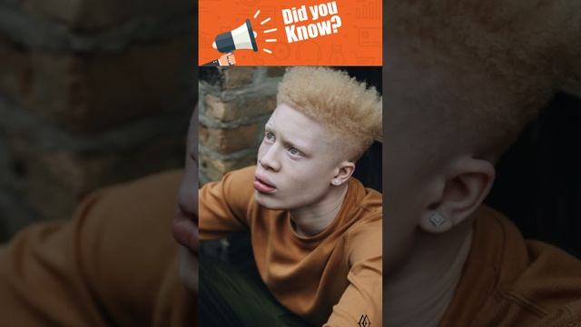 Amazing Albino Africans смотреть онлайн