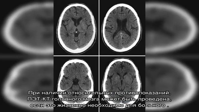 ПЭТ-КТ головного мозга - цены в Москве смотреть онлайн