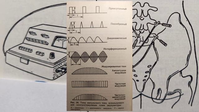 электроакупунктура и фармакопунктура на практике смотреть онлайн