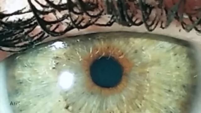 Новейшая методика изменения цвета глаз лазером смотреть онлайн