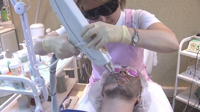 Косметологический аппарат 4S | ELOS (Элос) + IPL + RF + LASER