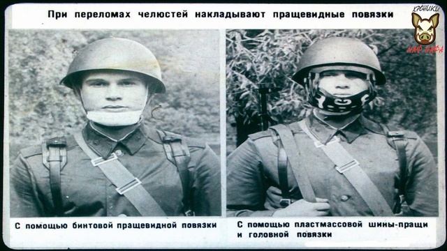 Первая медицинская помощь при переломах костей. 1977 год смотреть онлайн