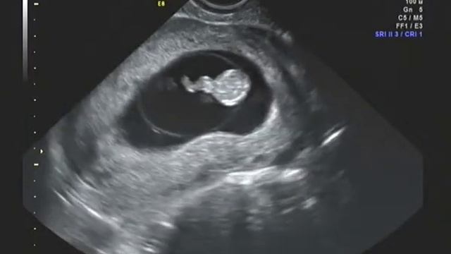 ПГ100 смотреть онлайн