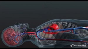 Сердечно - легочная реанимация Непрямой массаж сердца