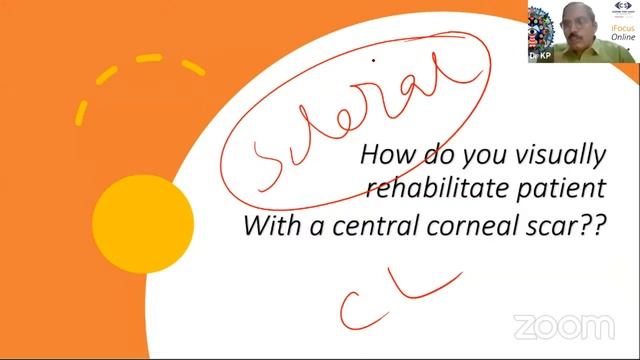 iFocus Online, Lecture 4: Clinical Optics and Refraction Module 2 смотреть онлайн