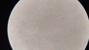 Кровь после гвоздики. Интересно!