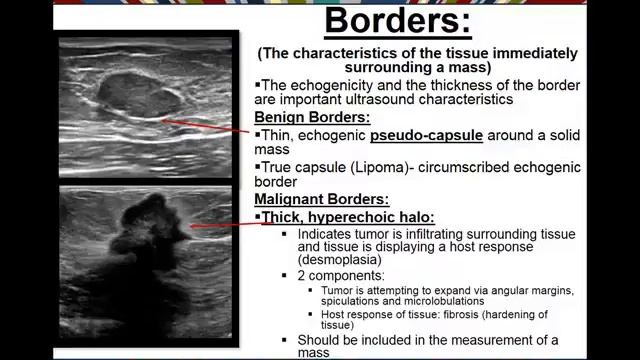 Benign Vs  Malignant Characteristics Of Breast Pathology On Ultrasound
