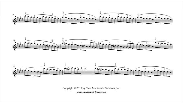 Kreutzer : Etude No. 11 in E Major - Violin смотреть онлайн