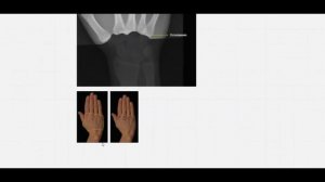 Анатомия лучезапястного сустава | Рентген-анатомия кисти и запястья