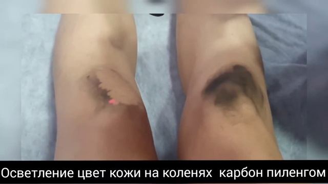 карбон пиленг смотреть онлайн