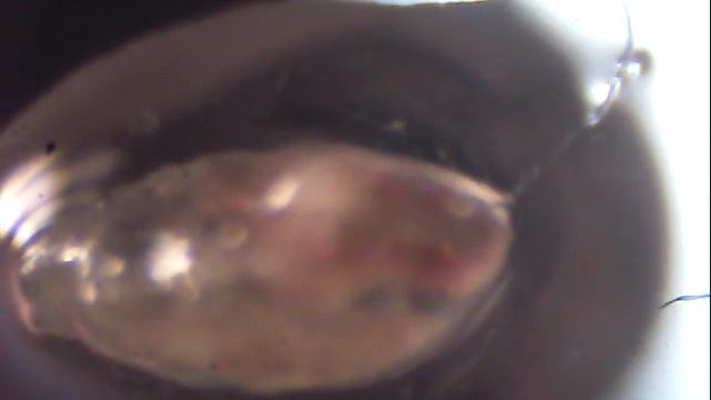 Clip0082.WMV Trematode stage смотреть онлайн