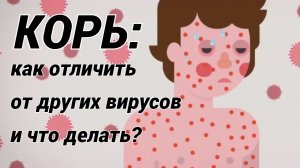 КОРЬ: вспышка кори в России! Симптомы и что делать?