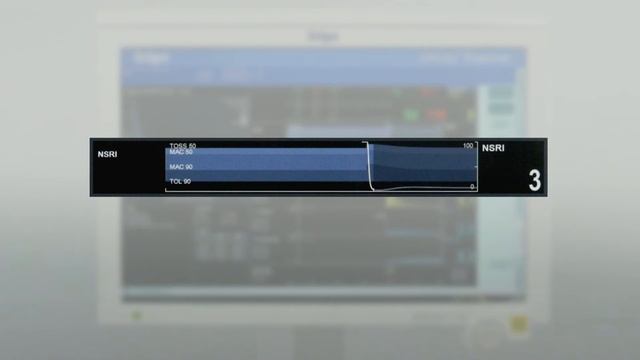 SmartPilot® View - Anesthesia decision support tool- How to start смотреть онлайн