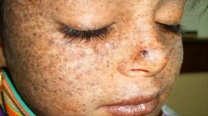 Ужасные генетические мутации, произошедшие с людьми и их последствия, подборка