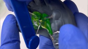 ? Несъемный ортодонтический аппарат. Правила активации для родителей