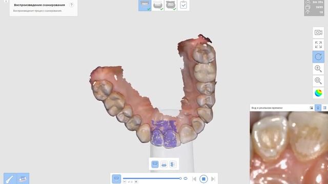 3D сканирование зубов в ИмиджСтоматология смотреть онлайн