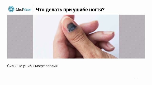 Как лечить ушиб ногтя? смотреть онлайн