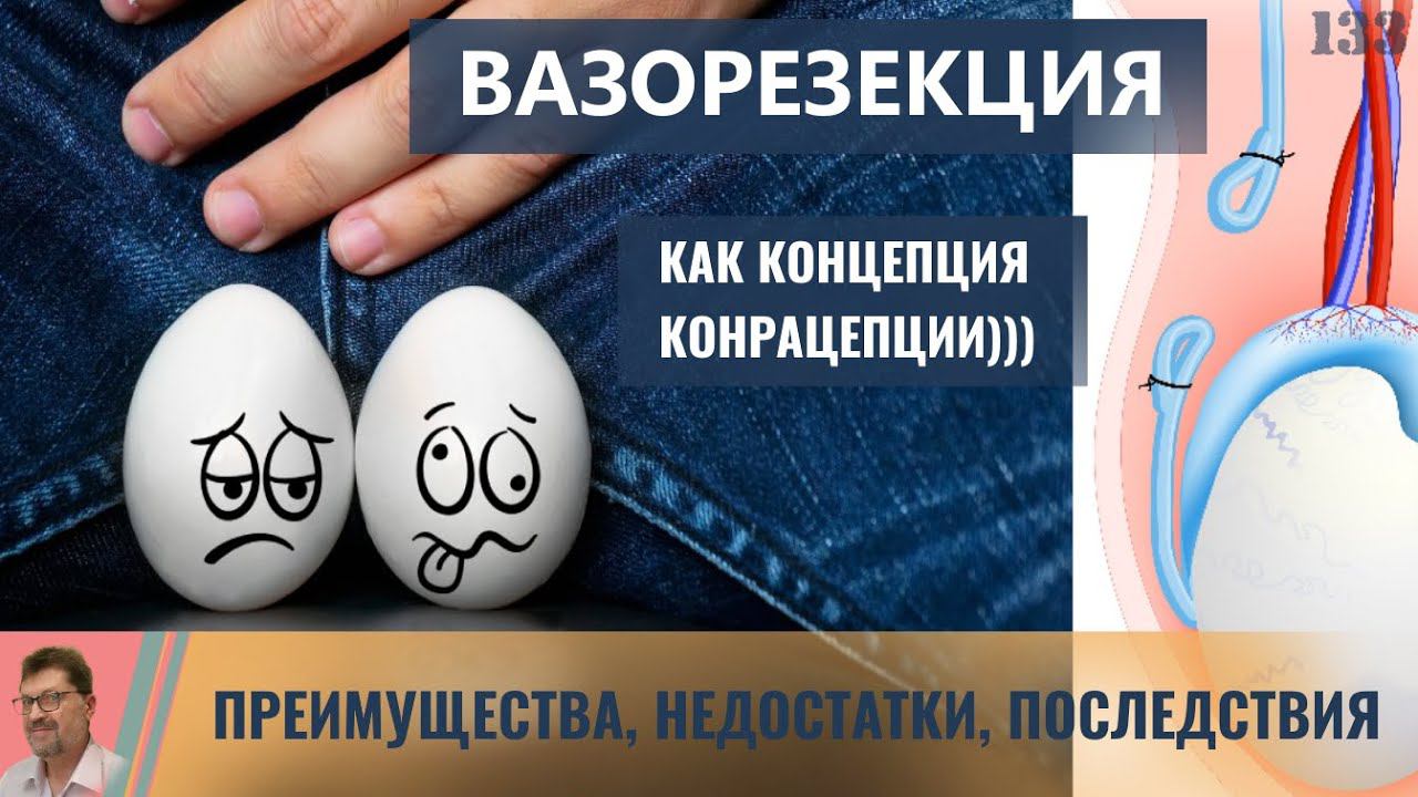 Вазорезекция (вазэктомия) как концепция контрацепции))) смотреть онлайн