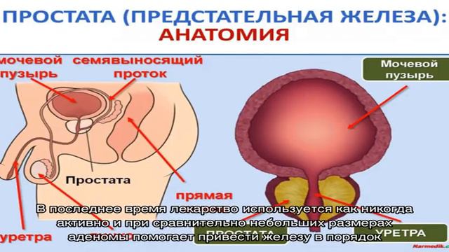 Медикаментозное лечение аденомы предстательной железы смотреть онлайн