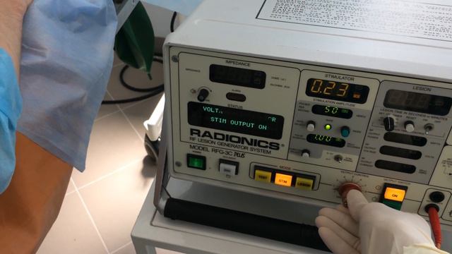 Радиочастотная абляция медиальной веточки первичной задней ветви спинномозгового корешка, алгология смотреть онлайн