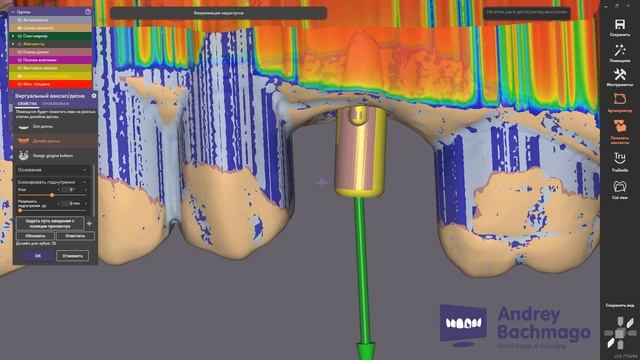 понедельничный exo лайфхак аппроксимальные контакты и виртуальный ваксап смотреть онлайн