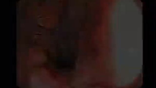 Свобода от гниения смотреть онлайн