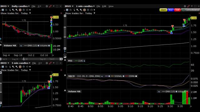 INVO +$22.52 Day Trading until I go broke 23 10 23 (Day 22) смотреть онлайн