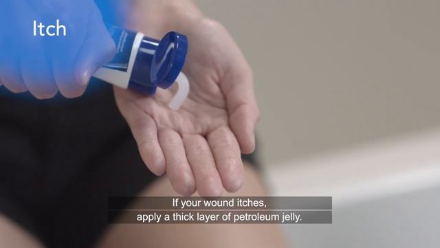 6 skin biopsy wound care tips from dermatologists смотреть онлайн