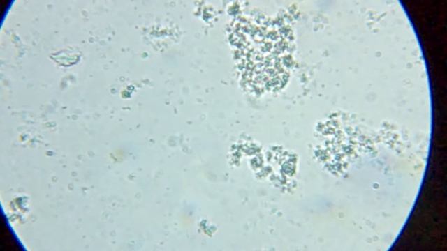 бактерии под микроскопом, Bacteria Under Microscope, X1000