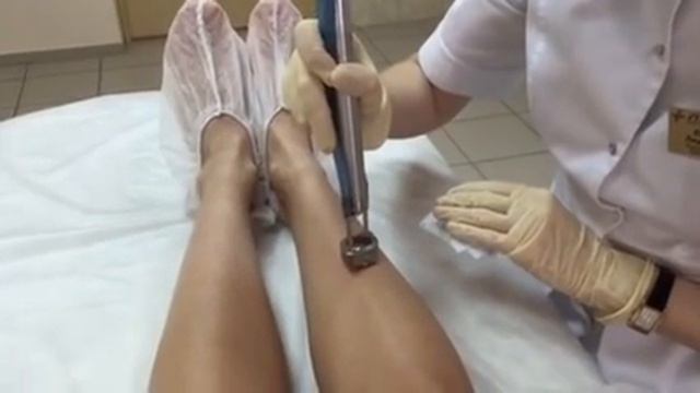 Лазерная эпиляция смотреть онлайн