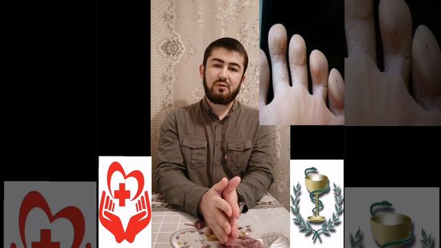 Грибоки пой ва нохунхо! Табобати пурра ва рохи пешгири и он.