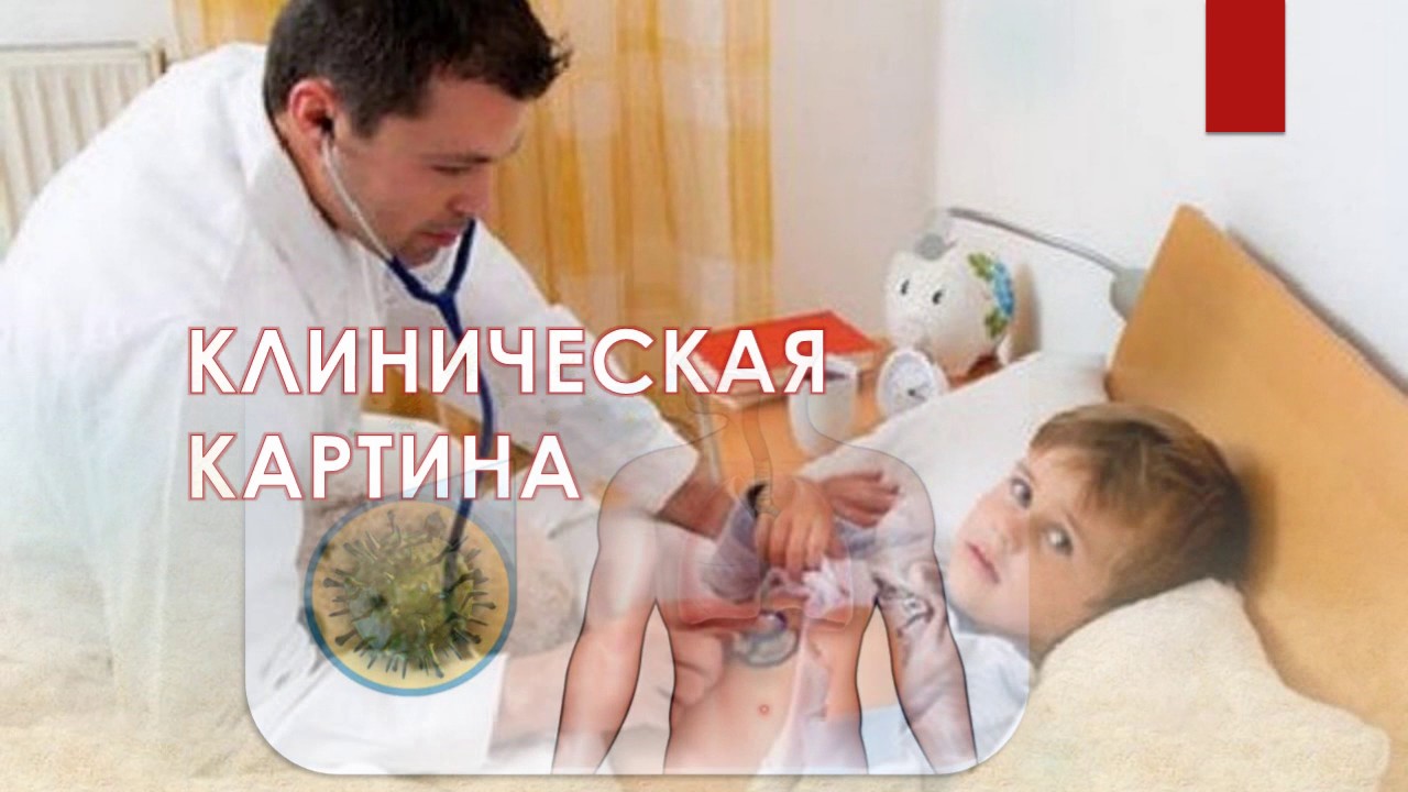 Краснуха смотреть онлайн