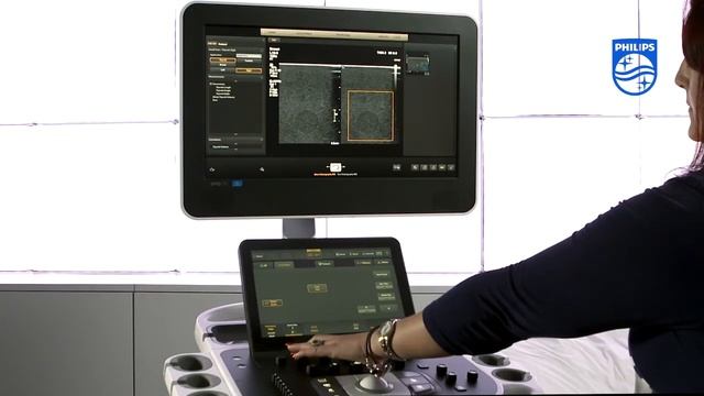 Компрессионная эластография на УЗИ сканерах Epiq Philips смотреть онлайн