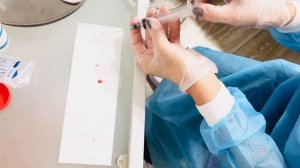 ПУНКЦИЯ ЩИТОВИДНОЙ ЖЕЛЕЗЫ