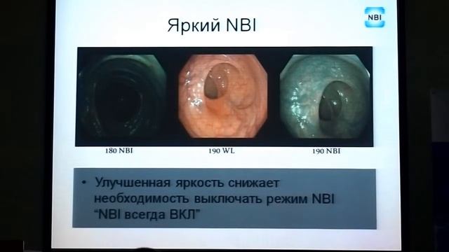 В Кутняк Особенности OLYMPUS EVIS EXERA III смотреть онлайн