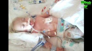 ►#ЧТО БУДЕТ #ЕСЛИ #РЕБЕНОК ПРОГЛОТИЛ #БАТАРЕЙКУ #чтоесли #What happens #if  child swallows a batter