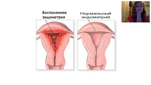 Особенности вегетарианства и сыроедения для женщин смотреть онлайн